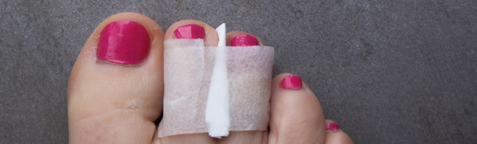 Buddy-tape injured toe